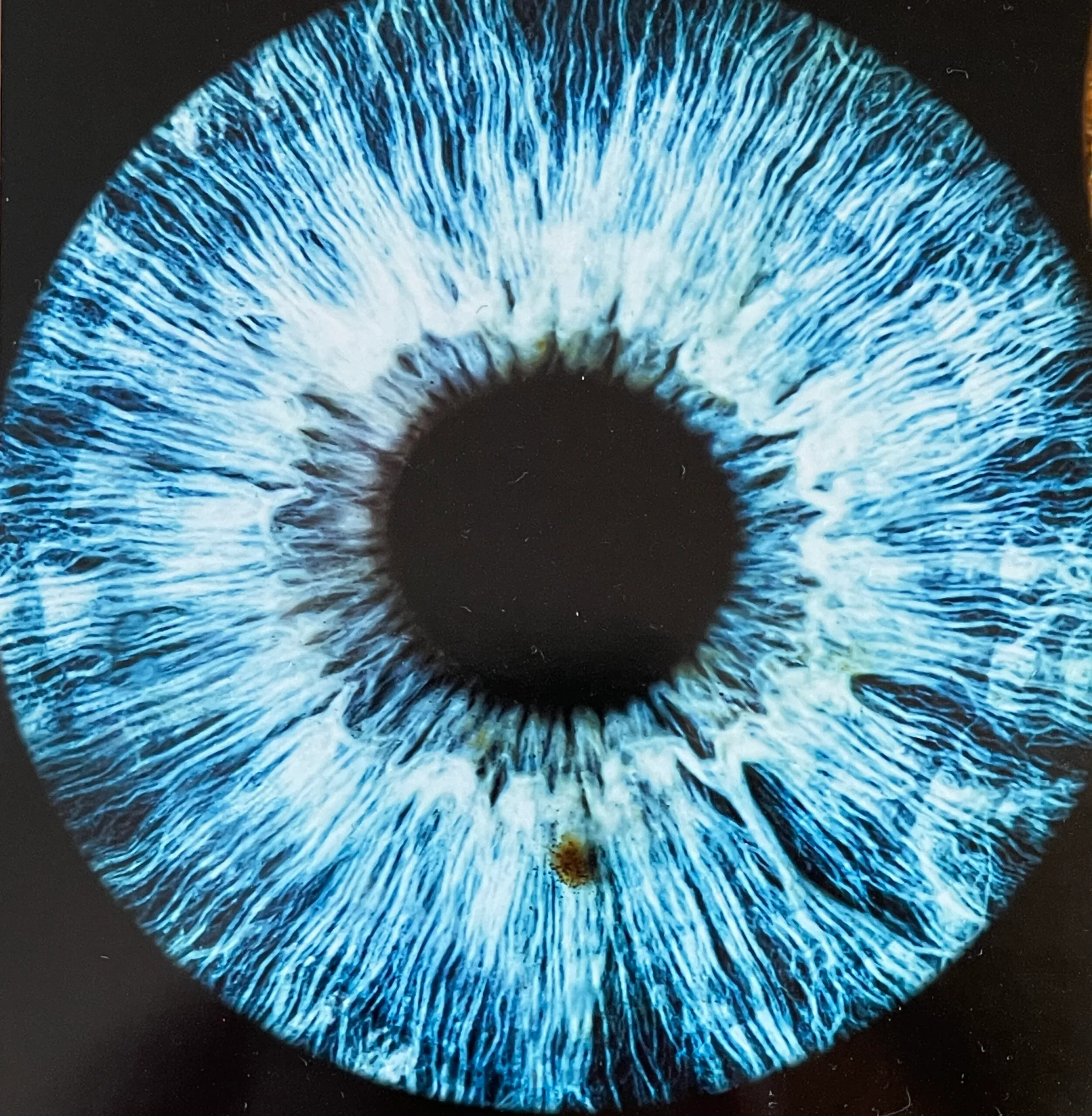 Irisdiagnose, Facereading